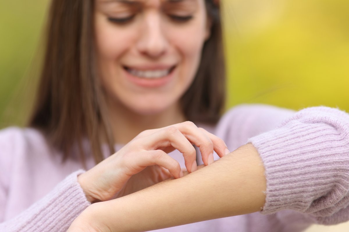 scratching arm from bug bite